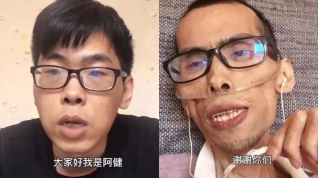 身体健康骨瘦如柴_骨瘦如柴中的柴是什么意思_柴瘦如骨图片